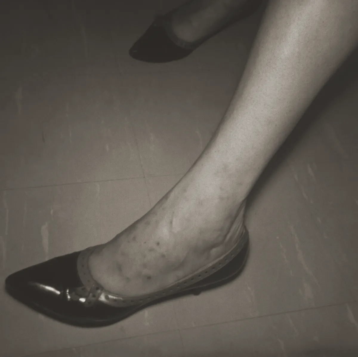 Black-and-white close view of a woman's ankle and the top of her foot above a pointed shoe, with small dark spots in loose clusters