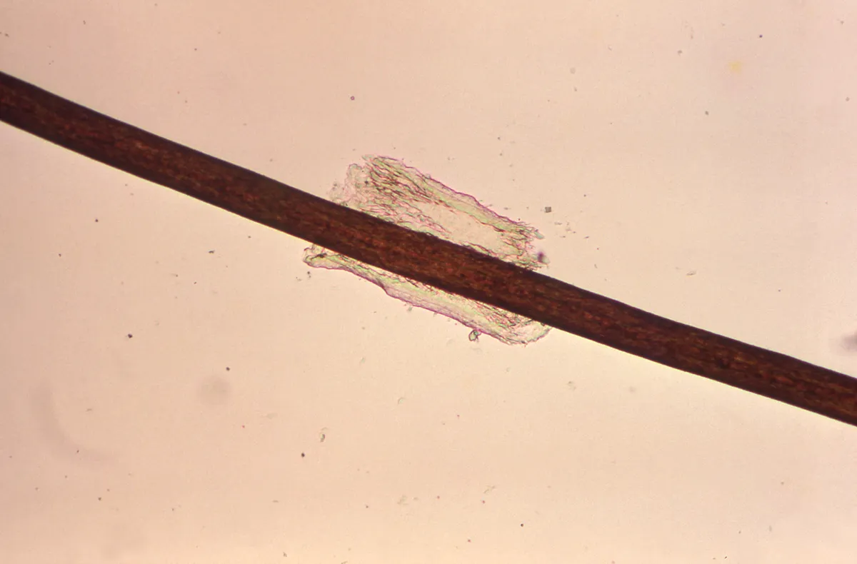 Magnified dark hair shaft with a pale, ragged sleeve of tissue wrapped around it