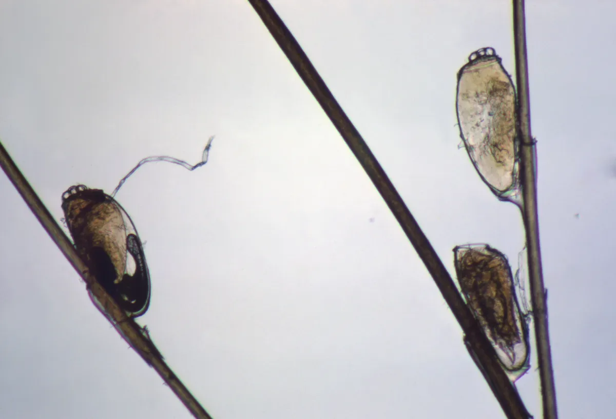 Three oval louse eggs magnified on hair shafts against a pale background, each glued at one end to the side of a hair, the left one dark inside