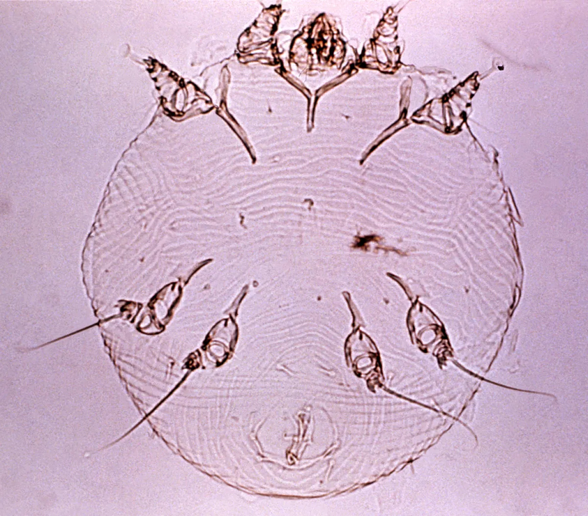 Microscope view of a round, nearly transparent human itch mite with short legs and long bristles