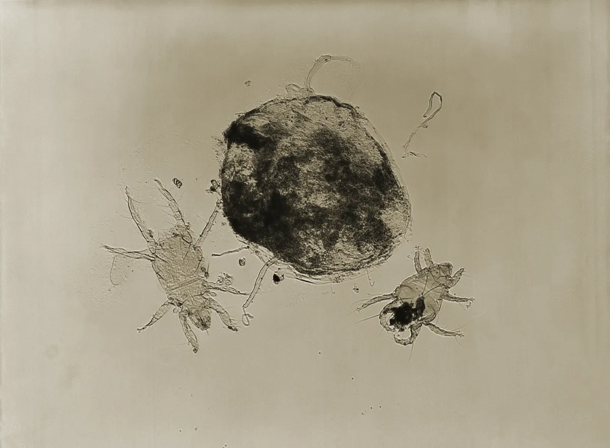 Microscope view of two pale straw itch mites with long legs beside the dark, swollen round abdomen of a female