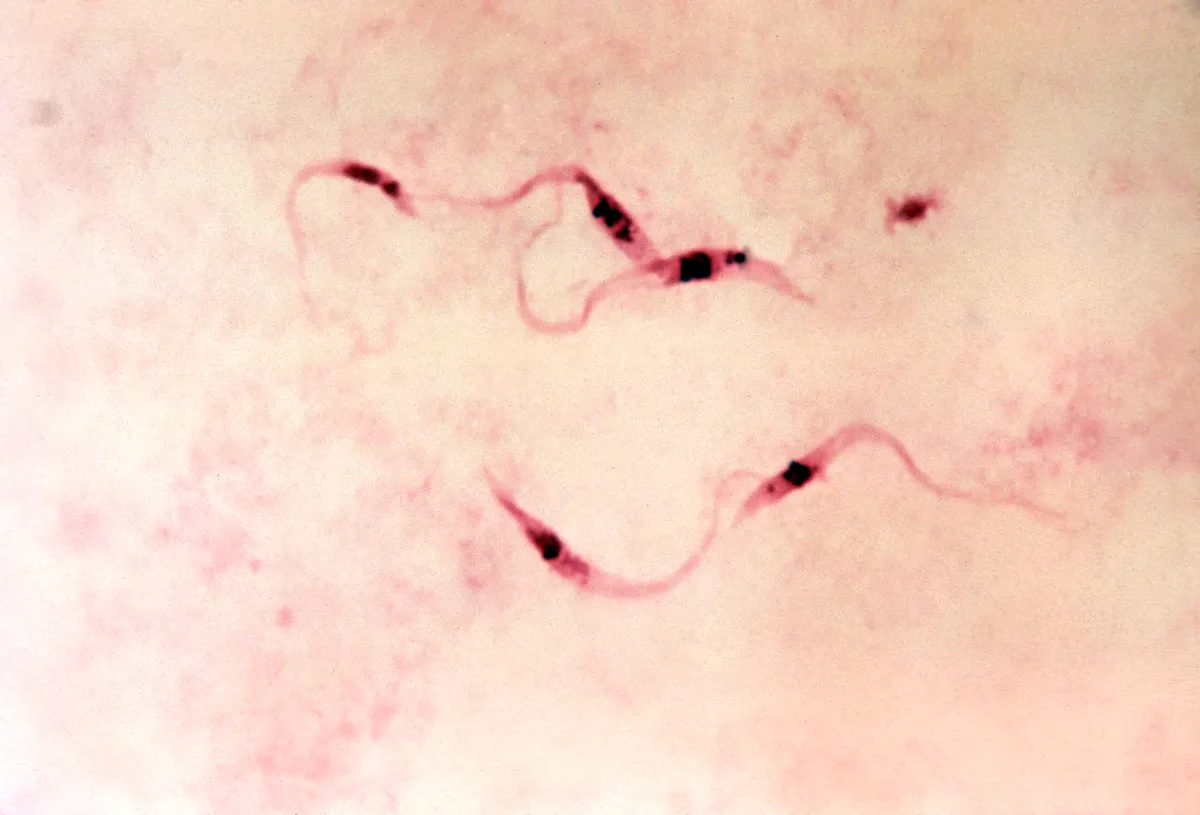 Pink-stained blood smear under a microscope showing several thin, wavy, ribbon-shaped parasites, each with a dark spot in its body